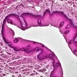 First It Was Mini-Livers; Now Science Can Give You a Bonus Pancreas as Well?