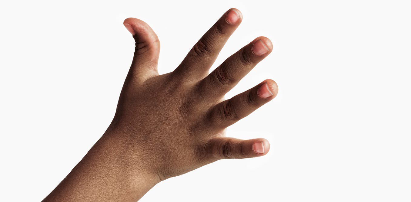 Why are our fingers different lengths?