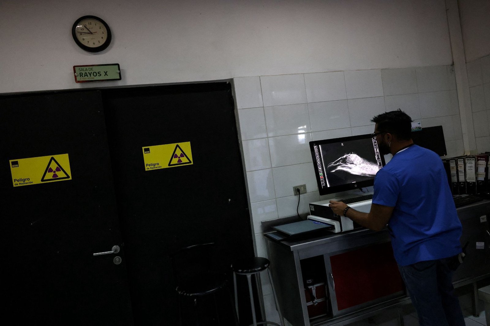 AI outperforms doctors in ER diagnoses