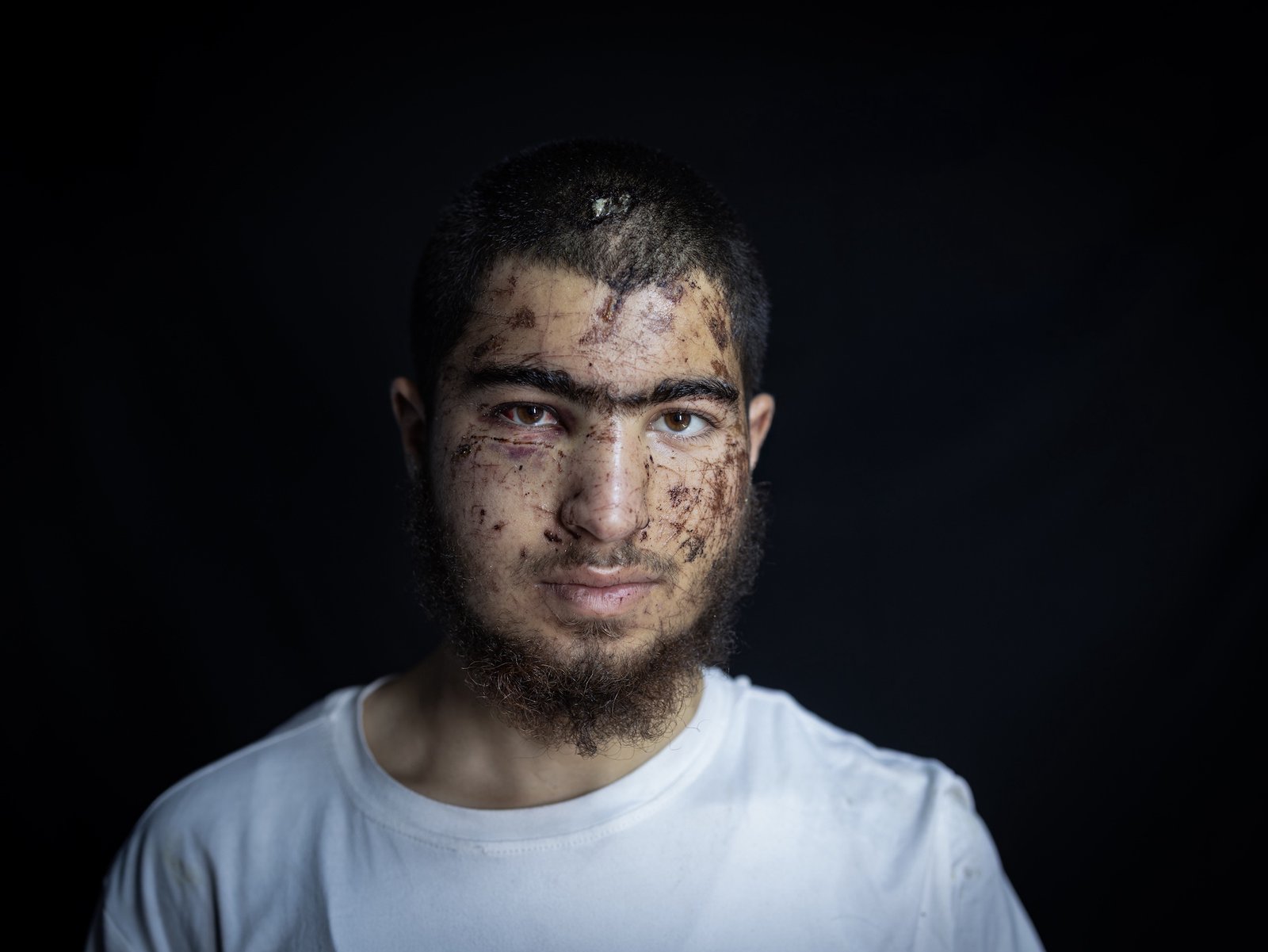 Anatomy of a settler abduction