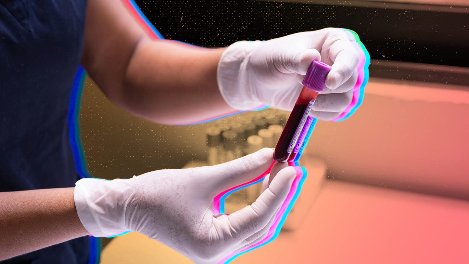  Should You Take The Alzheimer’s Blood Test? 