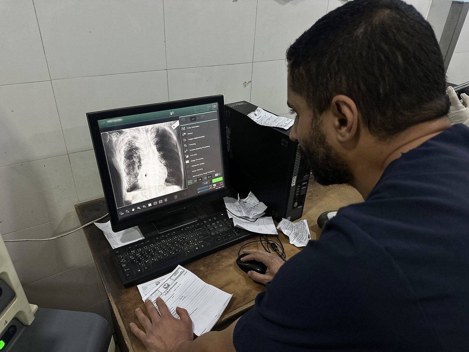 ‘As doctors, we are effectively blinded’: Inside Gaza’s MRI crisis