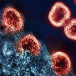 Trump CDC Plans to Cut $600 Million in HIV, STI Funding ... Only to Blue States