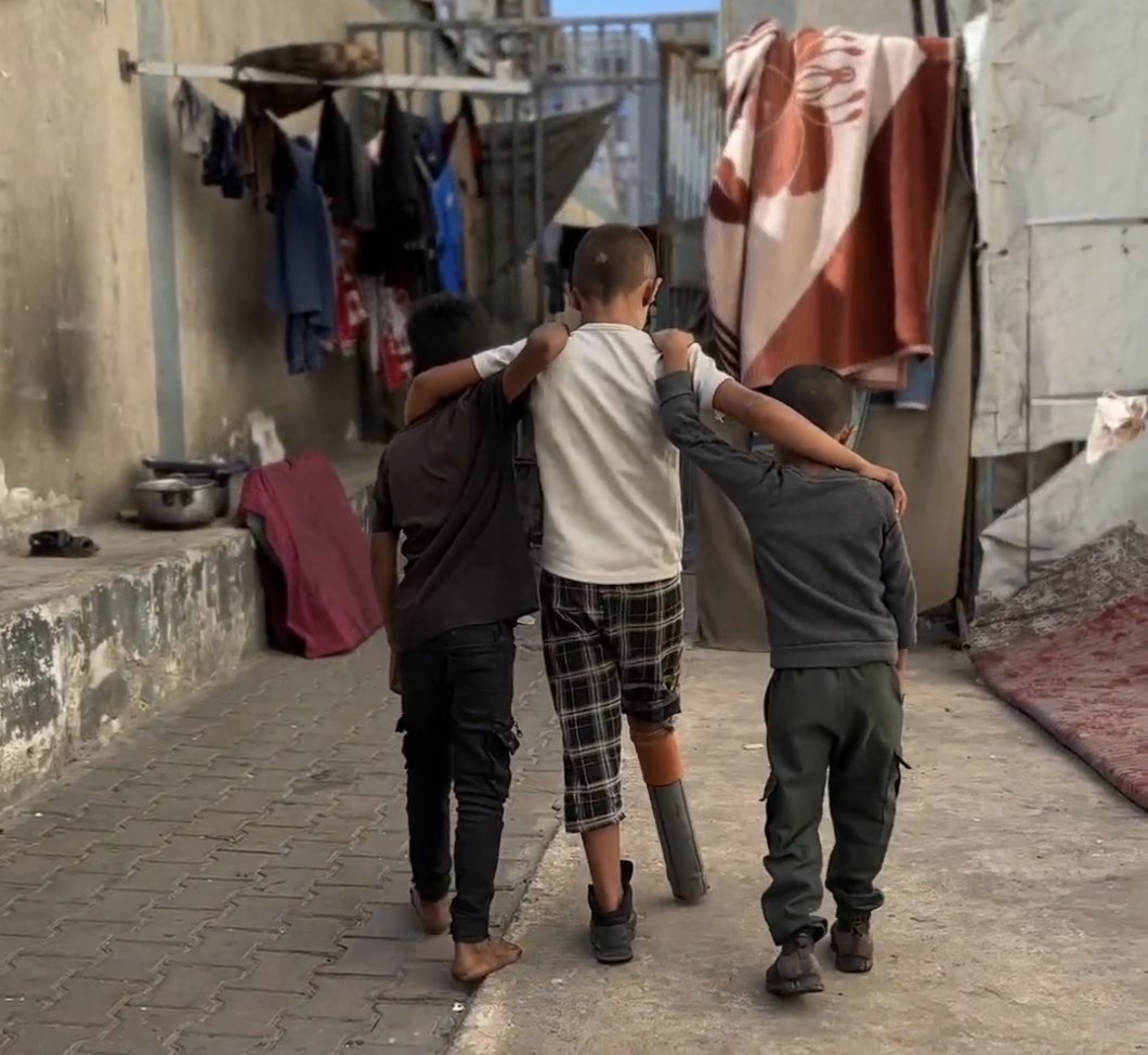 Child Amputees in Gaza Use Makeshift Prosthetics as Israel Restricts Medical Supplies