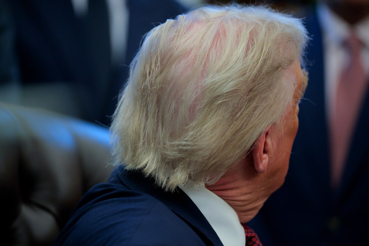 Mystery of Trump’s Hair-Loss Drug Exposes Bigger Issue With His Health