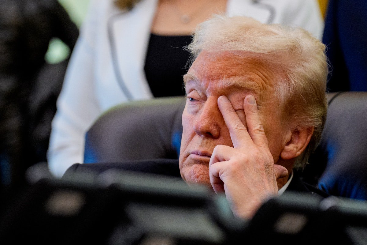 Trump Sports Swollen Eye Days After Surprise Medical Checkup