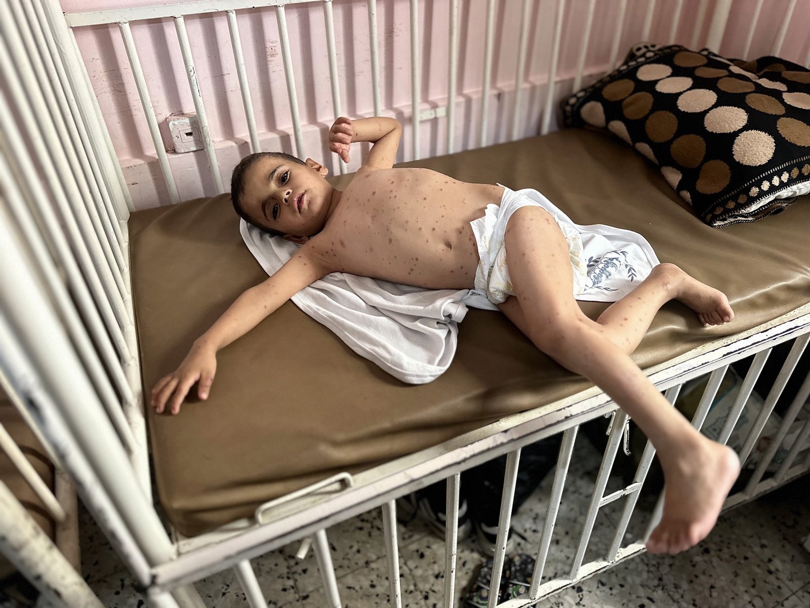 Rats, raw sewage, skin diseases: Israel’s siege is ravaging Gaza’s displaced