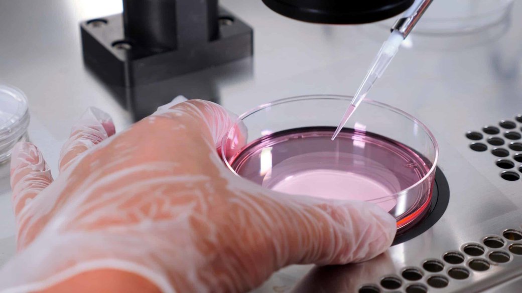 High Costs for Fertility Treatment Push Americans Abroad for IVF Services