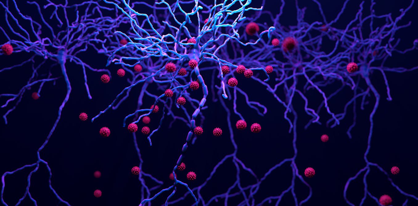 HIV enters the brain and doesn’t leave – paradoxically, drugs intended to reduce brain inflammation increase virus levels